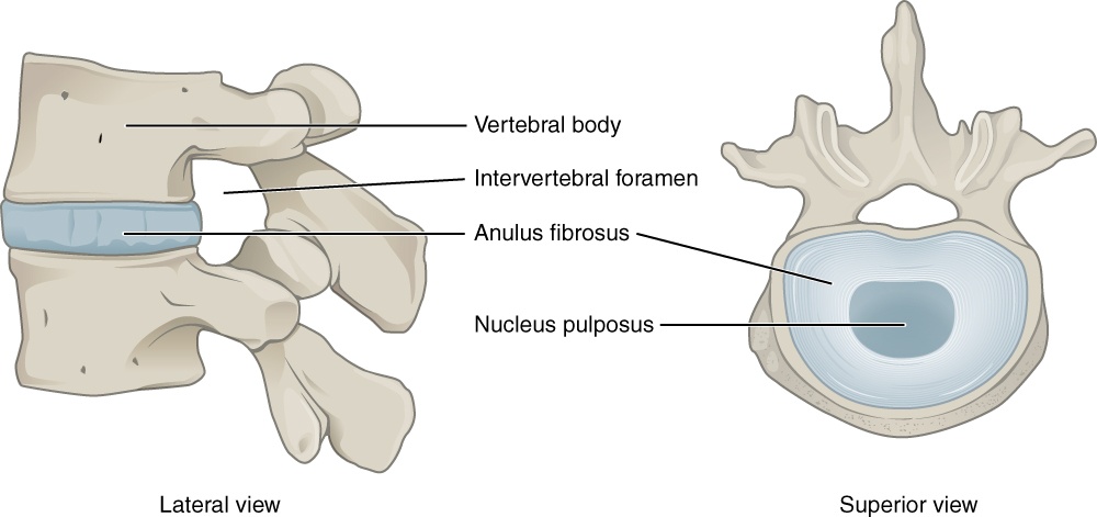 Decompression at the Intervertebral Disc